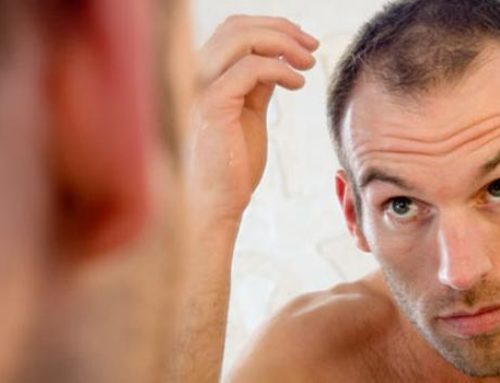 Efluvio Telógeno: Caída abundante del cabello