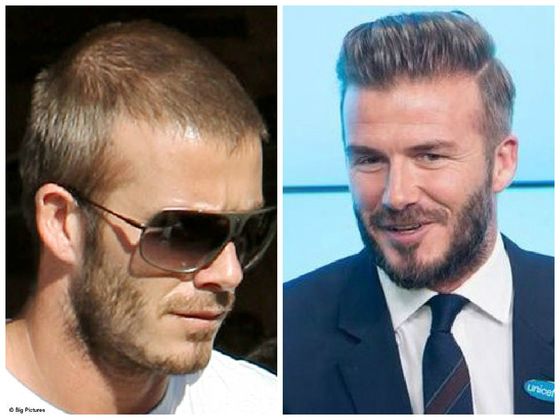 David-Beckham-pelo