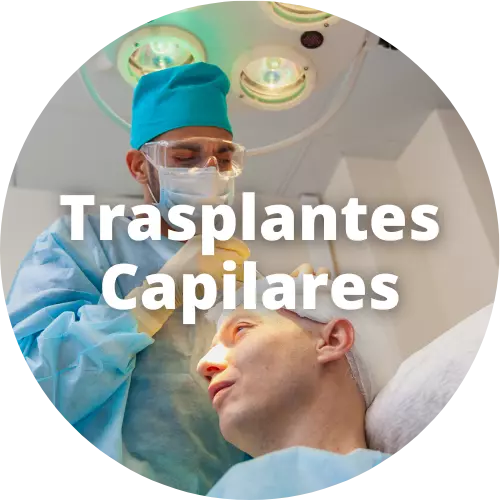 Trasplantes Capilares