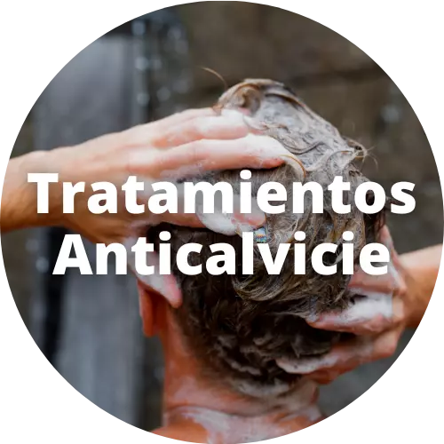 Tratamientos Anticalvicie