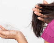 pérdida-de-cabello