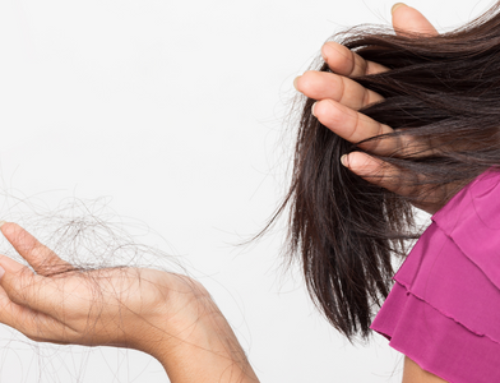 La pérdida de cabello | Consideraciones importantes