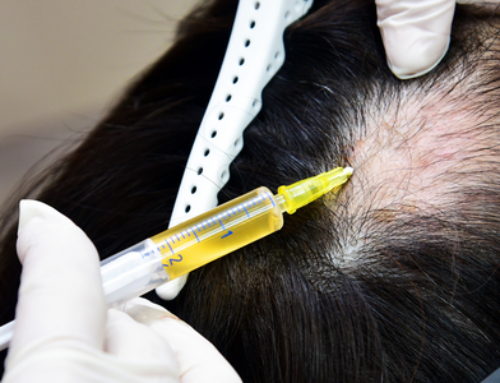 KeraMedix: Queratina Inyectada para el Crecimiento del Cabello