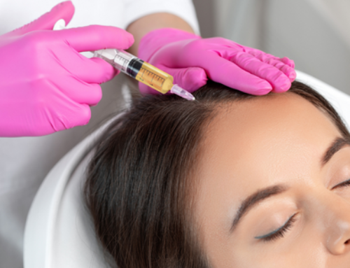 Mesoterapia Capilar, un tratamiento eficaz