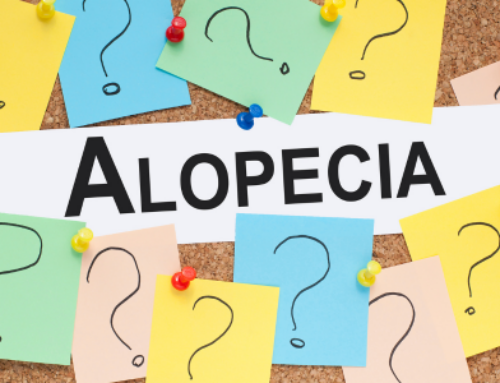 Alopecia androgénica en mujeres: Causas, diagnóstico y tratamiento
