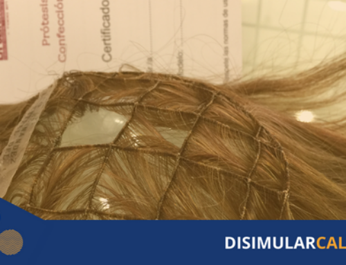 Sistema de integración capilar: solución estética para la calvicie
