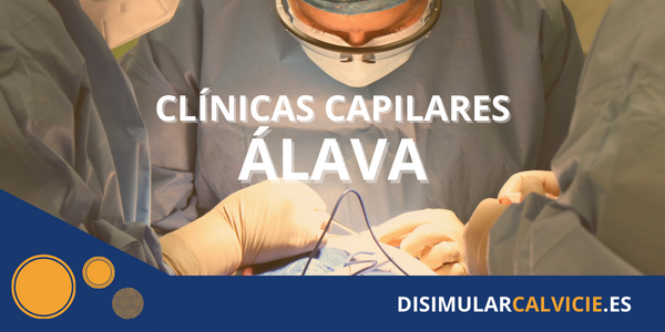 clinicas capilares en Alava