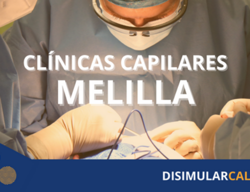 Clínica capilar Melilla: Recupera tu cabello en las manos expertas de nuestros profesionales