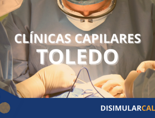 Clínica capilar Toledo: Recupera tu cabello en las manos expertas de nuestros profesionales