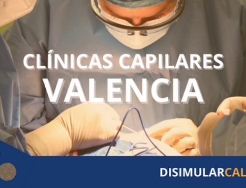Clínica capilar Valencia: Recupera tu cabello en las manos expertas de nuestros profesionales