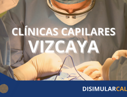 Clínica capilar Vizcaya: Recupera tu cabello en las manos expertas de nuestros profesionales