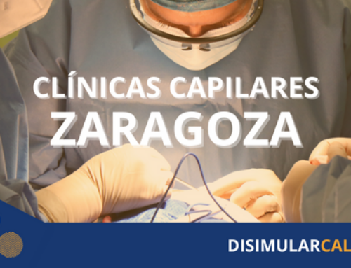 Clínica capilar Zaragoza: Recupera tu cabello en las manos expertas de nuestros profesionales