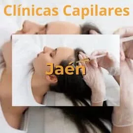 clinicas capilares en Jaén
