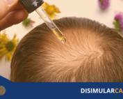 activos naturales contra la calvicie