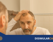parche con microagujas para la alopecia areata