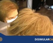 engrosamiento del cabello no quirúrgico