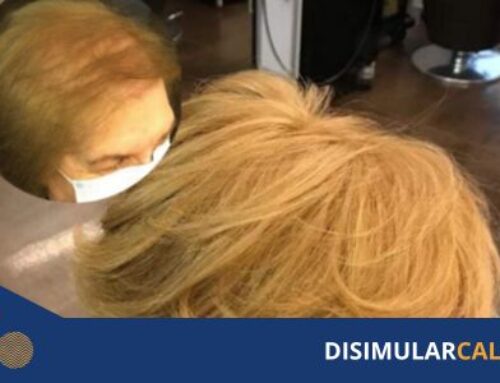 Engrosamiento del cabello: soluciones no quirúrgicas