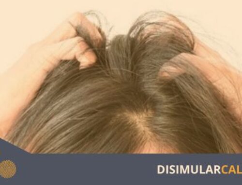 Triamcinolona y minoxidil en la calvicie de patrón femenino