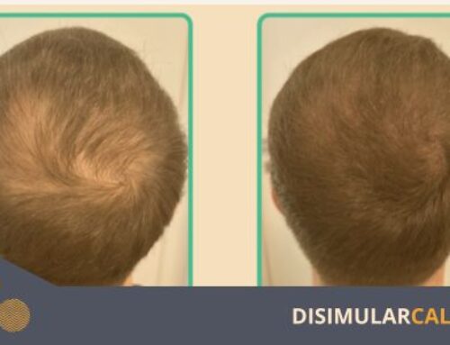 Tricopigmentación: qué es y cómo funciona